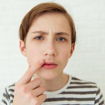 Um menino de olhos azuis e cabelo curto e loiro escuro, veste uma camiseta branca com listras horizontais pretas e aponta para a região do buço, sinalizando o crescimento de pelos. A foto faz alusão ao tema da puberdade precoce. 